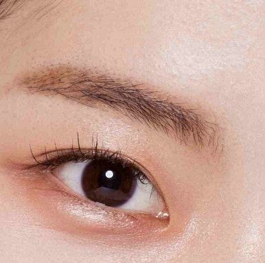 Why Dark Circle Treatment in Gangnam Requires Careful Consideration image 8