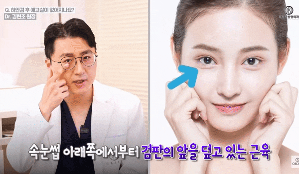 Worried About Lower Eyelid Scarring and Swelling? 김현조’s <Q&A> image 10