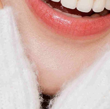 Why Dark Circle Treatment in Gangnam Requires Careful Consideration image 14