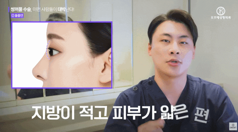 Characteristics of Eyes That Turn Out Great After Double Eyelid Surgery, as Explained by a Place Good at Double Eyelid Surgery! image 7