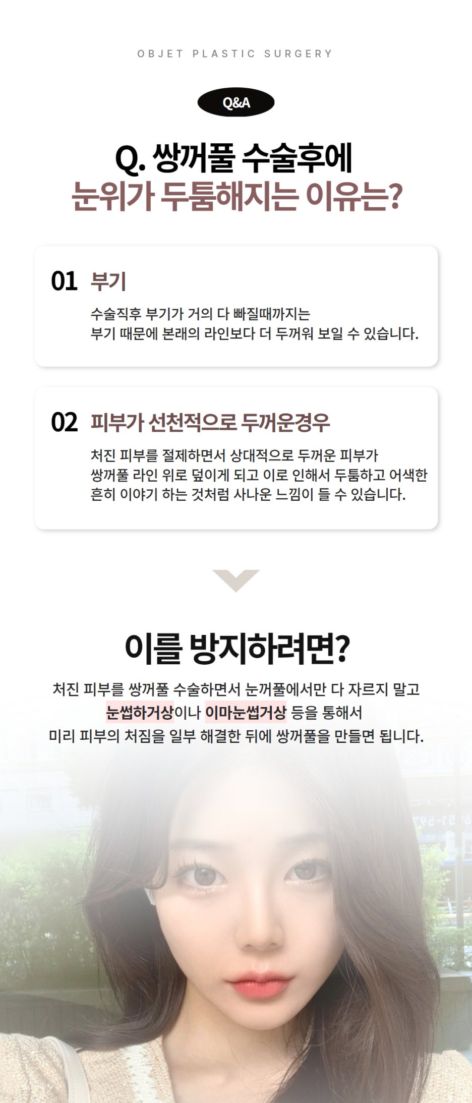 Questions About Double Eyelid Surgery in Gangnam image 3