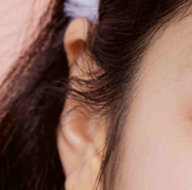 Why Dark Circle Treatment in Gangnam Requires Careful Consideration image 7