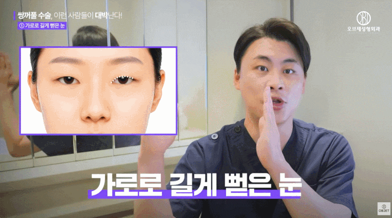 Characteristics of Eyes That Turn Out Great After Double Eyelid Surgery, as Explained by a Place Good at Double Eyelid Surgery! image 4