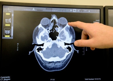 How to Resolve Nasal Congestion with Rhinoplasty, Obje Plastic Surgery image 8