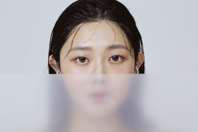 남성과 여성이 선호하는 성형부위 #오브제성형외과 관련 이미지 2