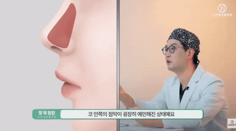 Is It Okay to Pick Your Nose After Nose Surgery? Director Jang Wook’s <Answer> image 5