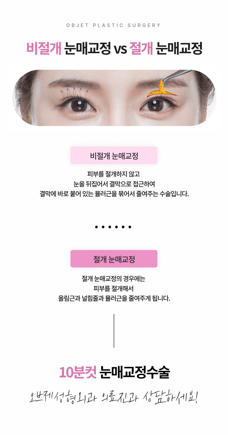 눈매교정수술추천 절개와 비절개 어떤게 나에게 필요할까? 관련 이미지 4