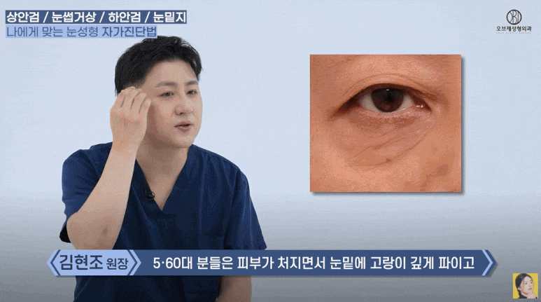 What Is the Difference Between Upper Eyelid and Lower Eyelid Surgery? Are There Different Procedures for Different Eyes? (Explanation by a Board-Certified Plastic Surgeon) image 18