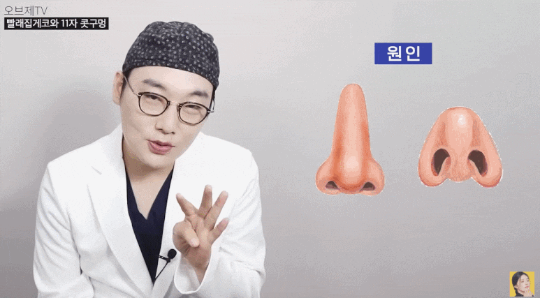 찝힌코 재수술? 빨래집게코, 11자코 해결 안 될까요? (성형외과 전문의 TIP) 관련 이미지 3