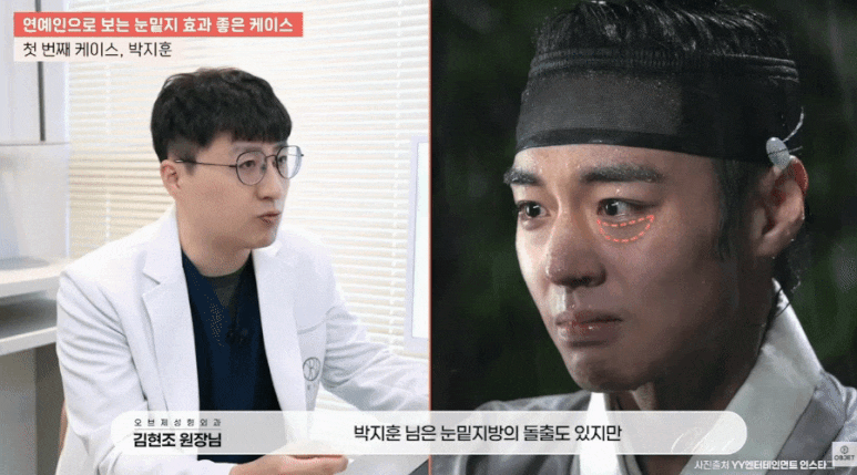 눈밑지 병원? 관련 이미지 6