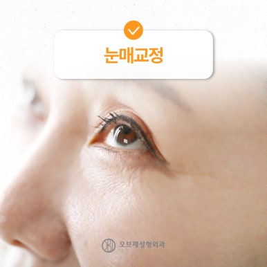강남 쌍꺼풀수술 나에게 맞게하는 방법 관련 이미지 6