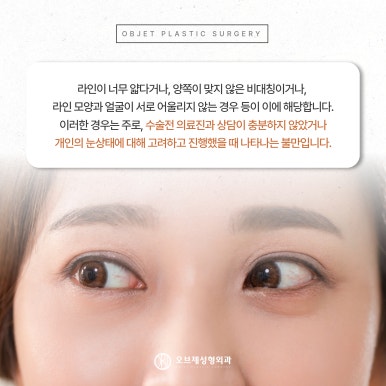Where to Get Good Revision Eye Surgery: 고민 After a First Failure image 6