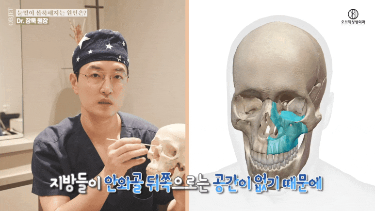 눈밑지방재배치 유지기간 성형외과 의사가 밝히는 2가지 진실! 관련 이미지 5