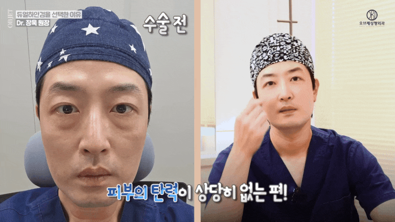 듀얼하안검 후기 매일 수술하던 의사가 직접 들려드립니다! 관련 이미지 7