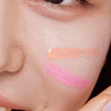 Why Dark Circle Treatment in Gangnam Requires Careful Consideration image 12