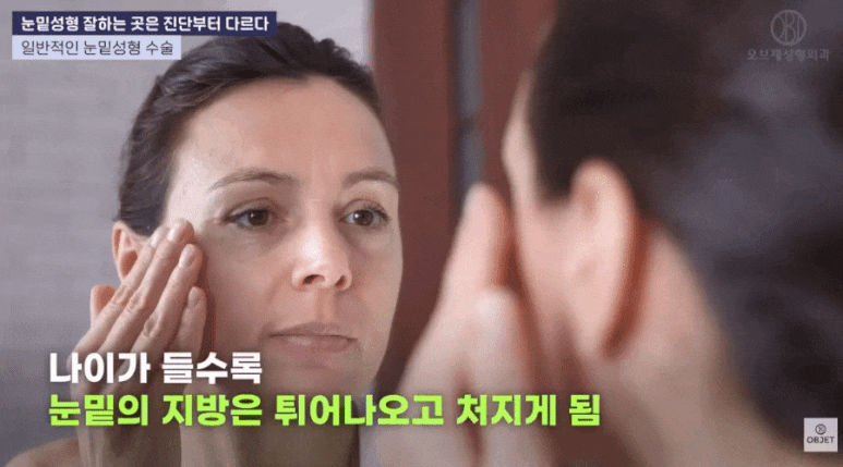 눈밑지병원추천, 김현조 원장님의 <Q&A> 읽고 가세요! 관련 이미지 2
