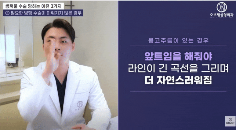 쌍꺼풀 부작용, 이 세 가지만 알면 피할 수 있어요! 관련 이미지 10