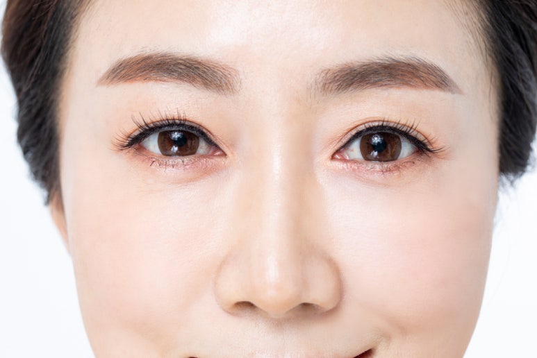 눈밑 뒤집힘, 애교살, 흉터 등 하안검수술 부작용 관련 이미지 10