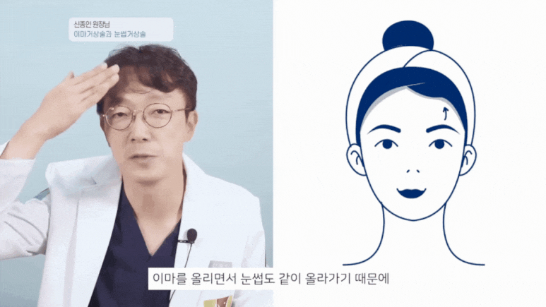 Forehead and Eyebrow Lift? A Selection Guide from Director Shin Jong-in image 9