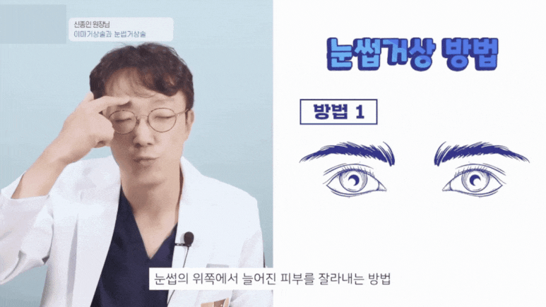 Forehead and Eyebrow Lift? A Selection Guide from Director Shin Jong-in image 3