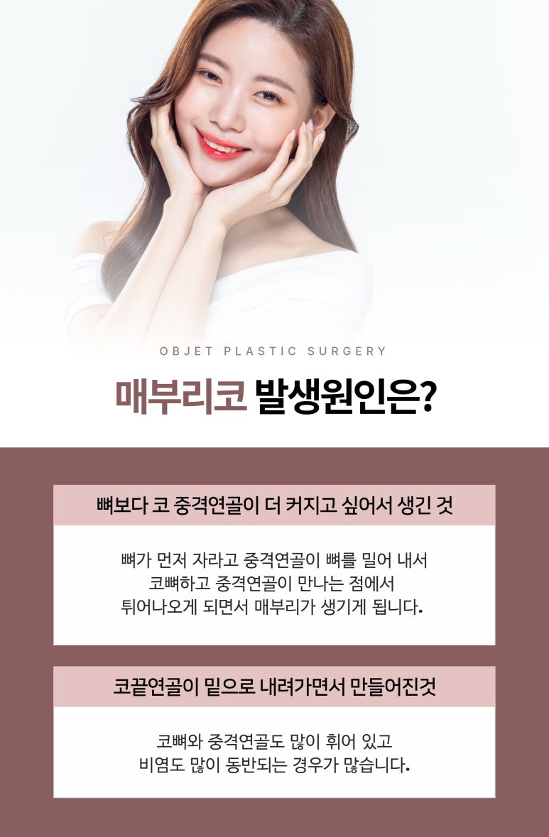 Causes of Hump Nose Rhinoplasty image 3