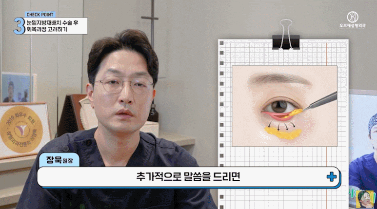 눈밑지 재발 이유? 세 가지만 알면 눈밑지방재배치 성공할 수 있어요! 관련 이미지 16