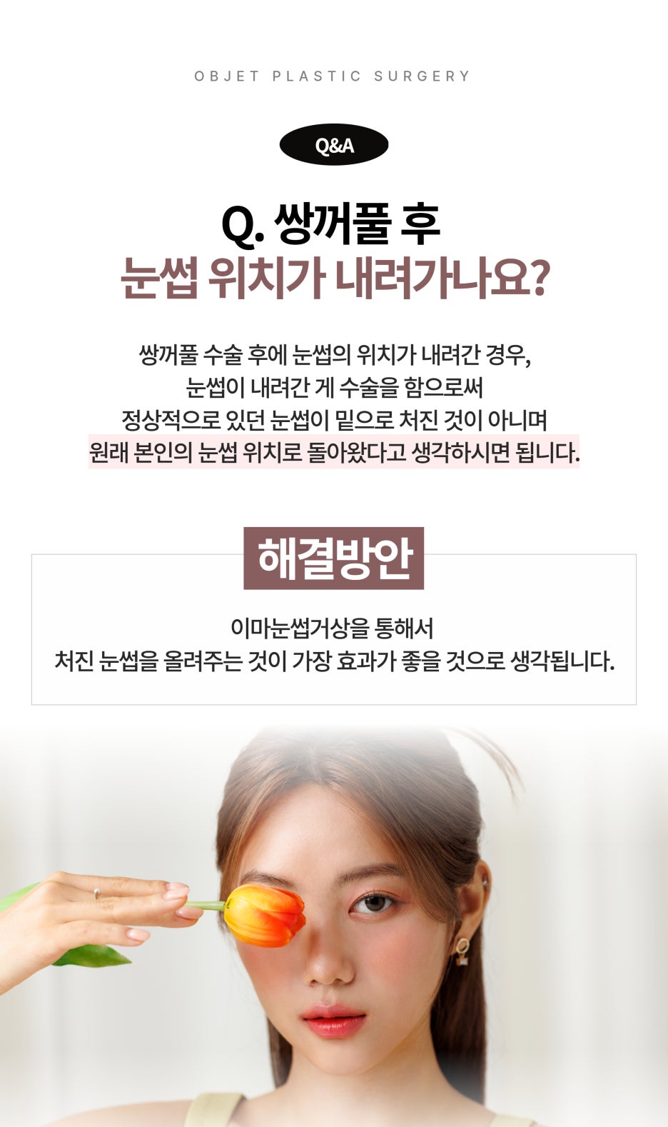 Questions About Double Eyelid Surgery in Gangnam image 5