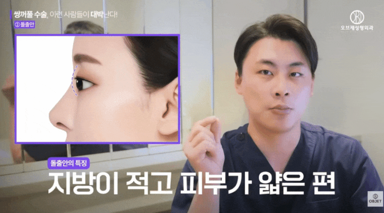 돌출눈 쌍수? 대박나는 눈 <특징> - 박시현 원장님 정리 관련 이미지 2