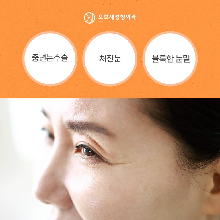 늘어지고 처지는 중년눈수술 관련 이미지 2