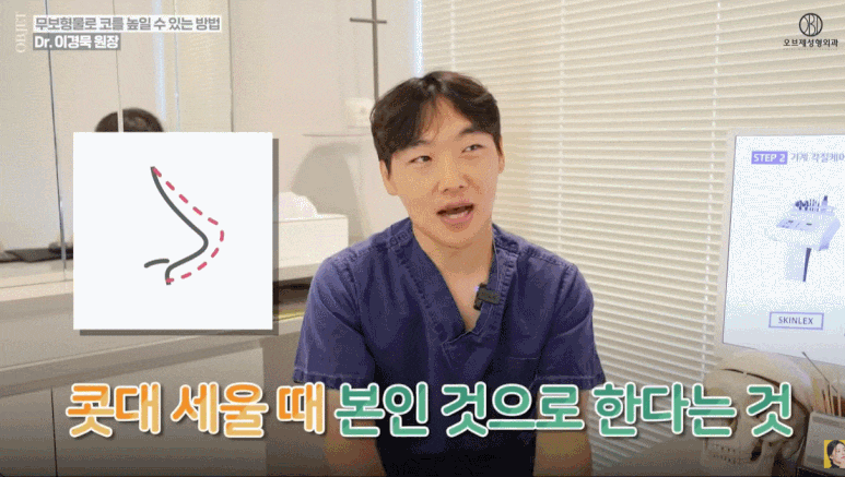 무보형물코성형 효과와 수술방법 관련 이미지 4