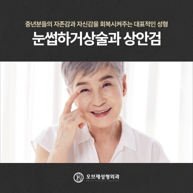 Fine Wrinkles Beside the Eyes, Brow Lift image 2