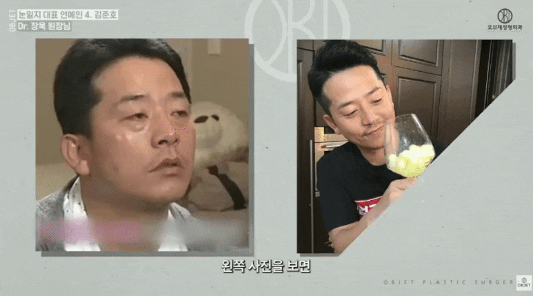 눈밑지방재배치 연예인 TOP 5! 장욱 원장님이 분석해 드립니다 관련 이미지 8