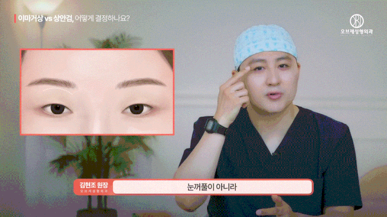 이마거상 상안검 고민하셨나요? 수술 전 이 관련 이미지 4