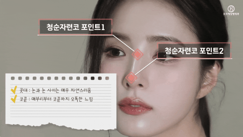 코성형 연예인 사진 TOP 2 신세경&middot;오연서 코 뭐가 다를까? 관련 이미지 20