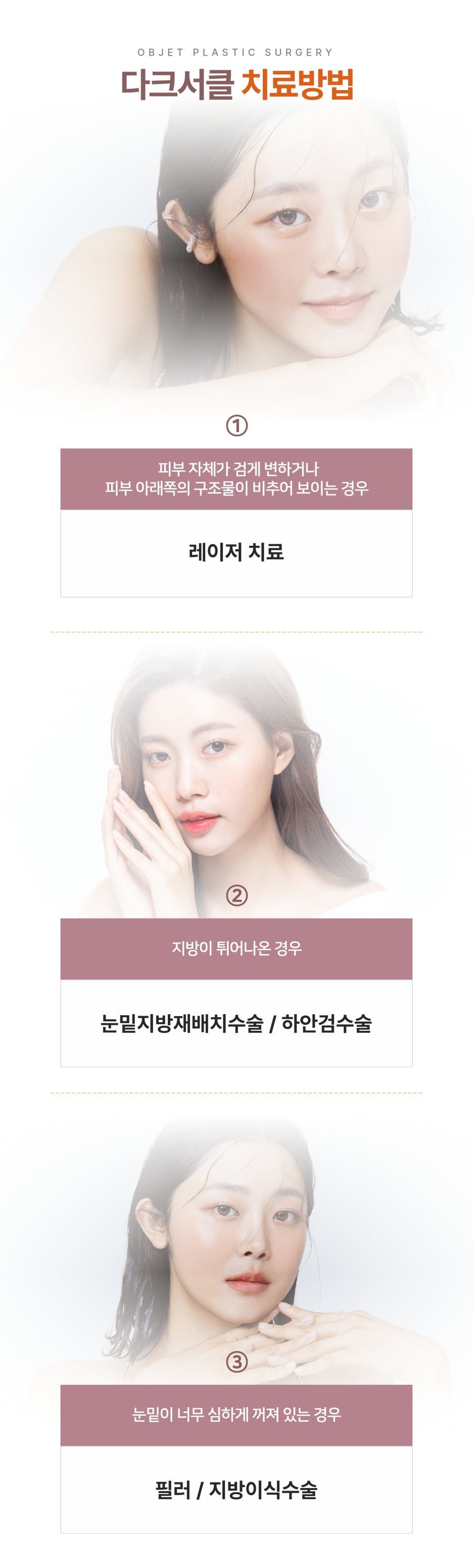 Why Dark Circle Treatment in Gangnam Requires Careful Consideration image 4