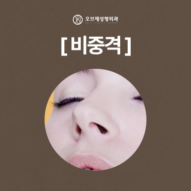 Natural Tip Rhinoplasty #Yeoksam-dong#Gangnam image 4