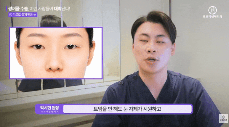 돌출눈 쌍수? 대박나는 눈 <특징> - 박시현 원장님 정리 관련 이미지 3