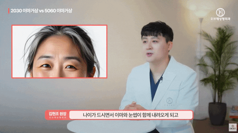 40대 이마거상과 20대 30대의 이마거상의 차이점 전격 비교! (성형외과 전문의 설명) 관련 이미지 9