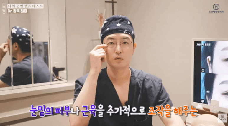눈밑처짐 수술 고민? 장욱 원장님이 알려주는 셀프 테스트! 관련 이미지 7