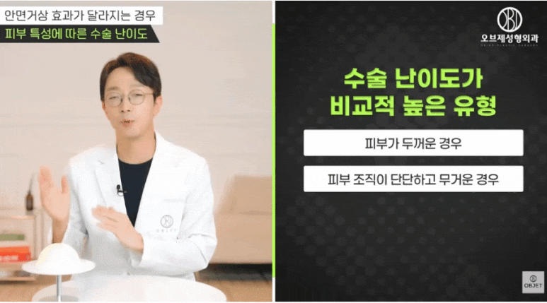 안면거상술 효과? 관련 이미지 6