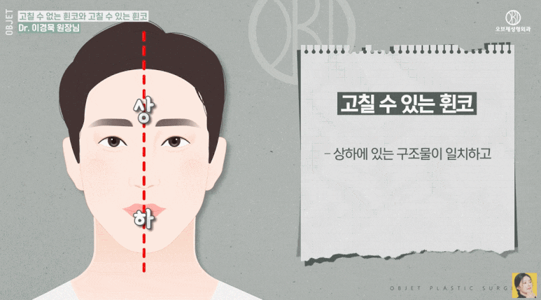 If You’re Looking for a Good Place for Crooked Nose Surgery, Read This First! Dr. Lee Kyung-mook Explains Which Crooked Noses Can Be Corrected image 3