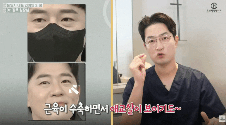 눈밑지방재배치 연예인 TOP 5! 장욱 원장님이 분석해 드립니다 관련 이미지 6