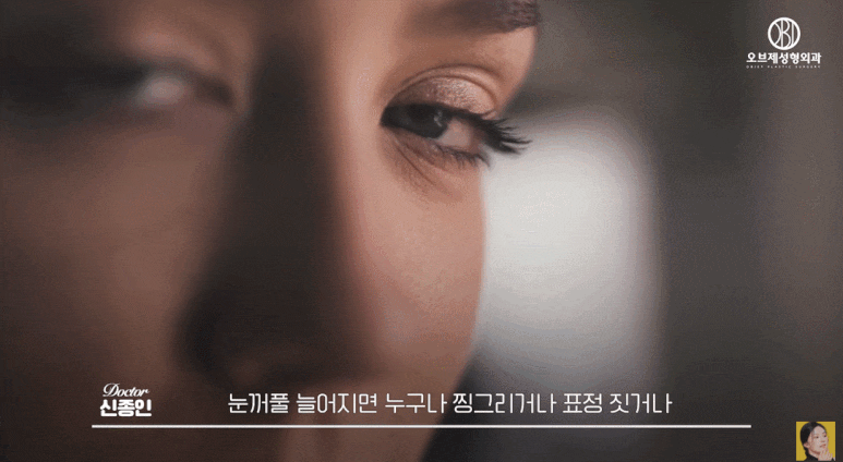 중년 쌍수 짝짝이 눈 스트레스? 맞춤 교정이 가능한 곳을 찾아야 하는 이유 관련 이미지 3