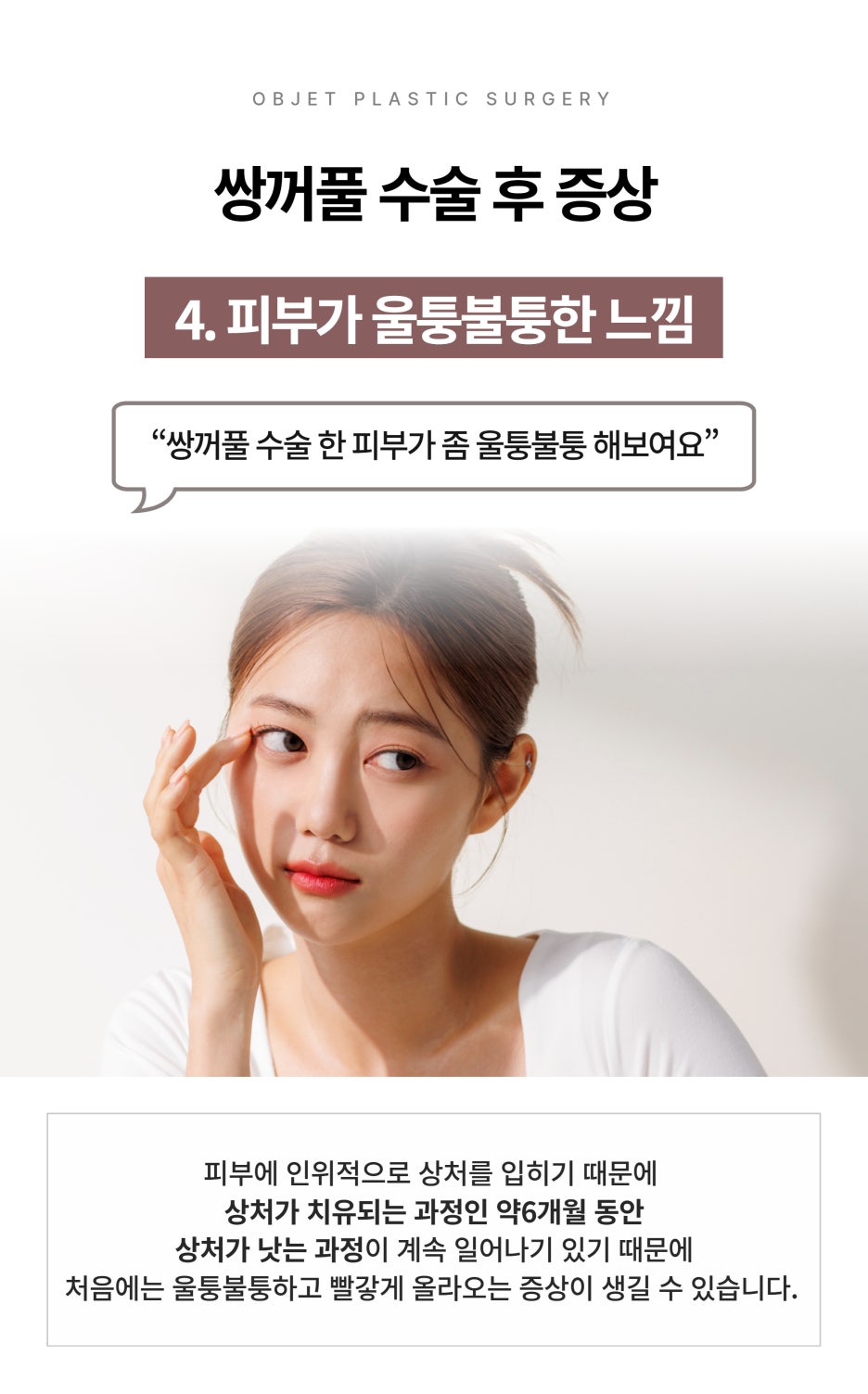 Symptoms After Double Eyelid Surgery at Gangnam Station Plastic Surgery image 9