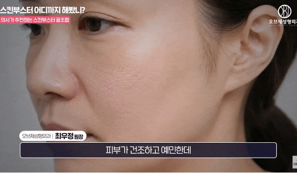 Rejuran and Juvelook Together? Director Choi Woo-jung’s <Recommended Skin Boosters!> image 8