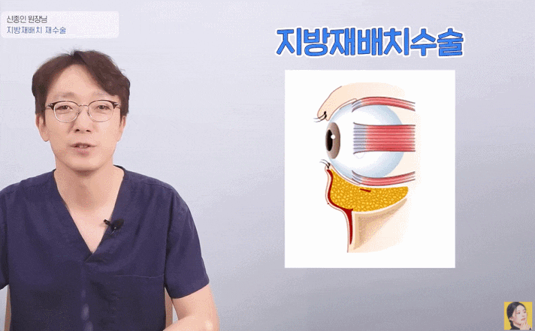 눈밑지방재배치재수술 꼭 알고 가야 하는 3가지! (성형외과 전문의 Q&A) 관련 이미지 2