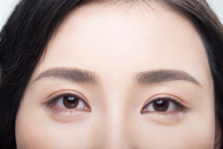 눈밑 뒤집힘, 애교살, 흉터 등 하안검수술 부작용 관련 이미지 4
