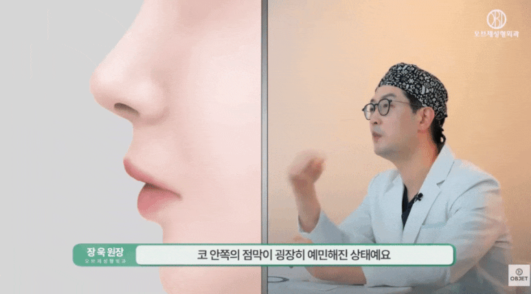 Can You Remove Nose Surgery Stitches Early? Director Jang Wook Answers! image 6