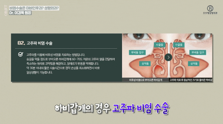 Nasal Surgery for Rhinitis: You Should Choose a Clinic That Knows ‘This’ Well! image 10