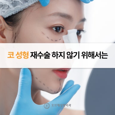 Conditions for Non-Implant Rhinoplasty image 7